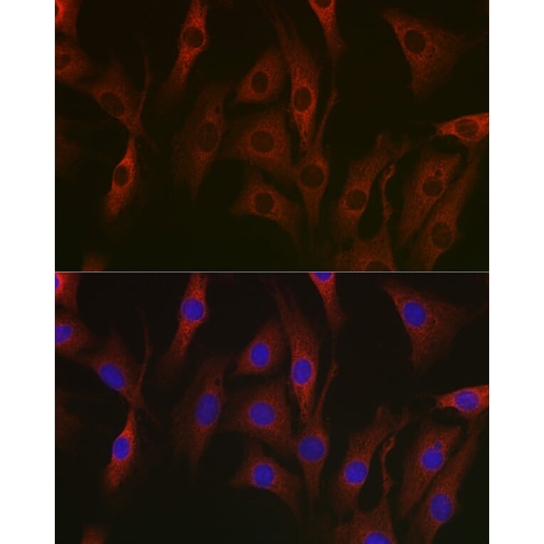 Immunofluorescence - Anti-NF-kB p65 Antibody [AMC0486] (A13014) - Antibodies.com