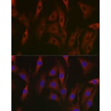 Immunofluorescence - Anti-NF-kB p65 Antibody [AMC0486] (A13014) - Antibodies.com