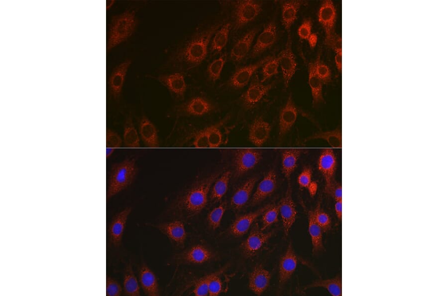 Immunofluorescence - Anti-NF-kB p65 Antibody [AMC0486] (A13014) - Antibodies.com