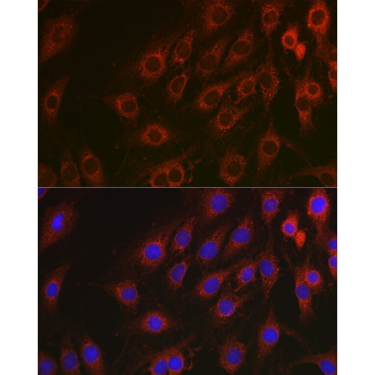 Immunofluorescence - Anti-NF-kB p65 Antibody [AMC0486] (A13014) - Antibodies.com