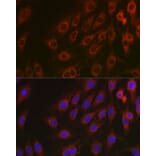 Immunofluorescence - Anti-NF-kB p65 Antibody [AMC0486] (A13014) - Antibodies.com