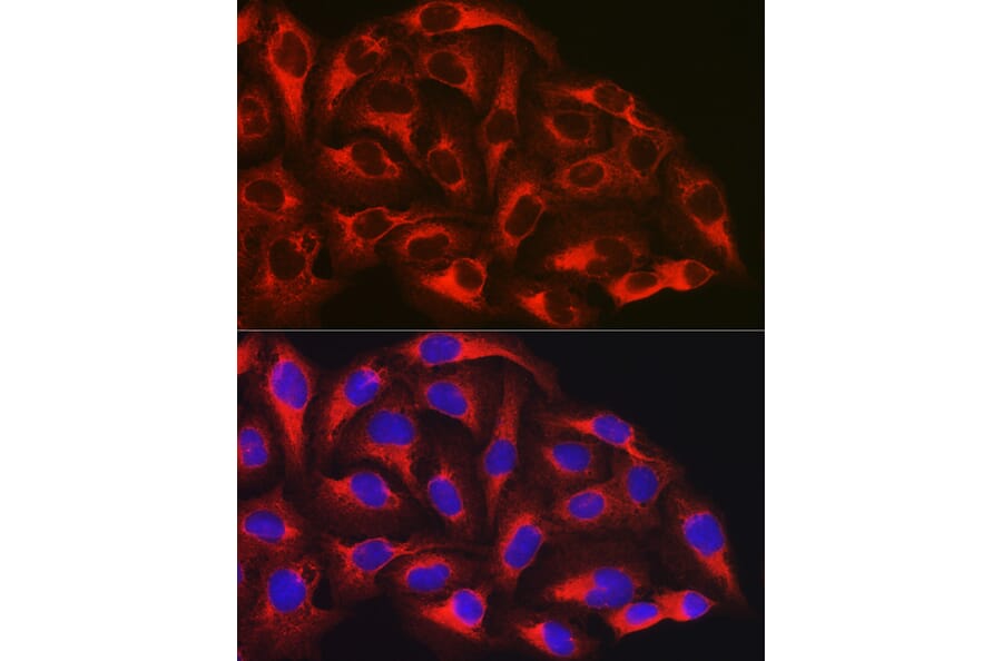Immunofluorescence - Anti-NF-kB p65 Antibody [AMC0486] (A13014) - Antibodies.com