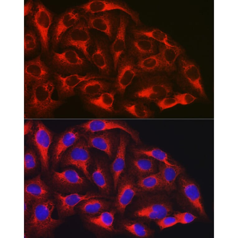 Immunofluorescence - Anti-NF-kB p65 Antibody [AMC0486] (A13014) - Antibodies.com