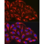 Immunofluorescence - Anti-NF-kB p65 Antibody [AMC0486] (A13014) - Antibodies.com