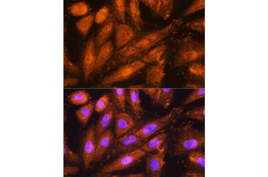 Immunofluorescence - Anti-Proteasome 19S S5A/ASF Antibody (A13015) - Antibodies.com