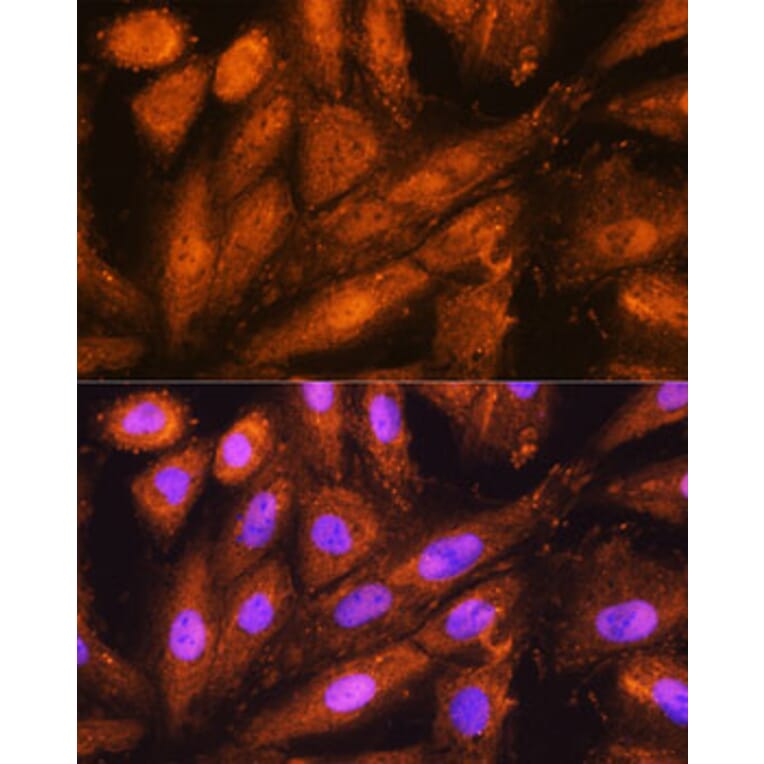 Immunofluorescence - Anti-Proteasome 19S S5A/ASF Antibody (A13015) - Antibodies.com