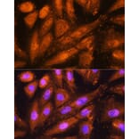 Immunofluorescence - Anti-Proteasome 19S S5A/ASF Antibody (A13015) - Antibodies.com