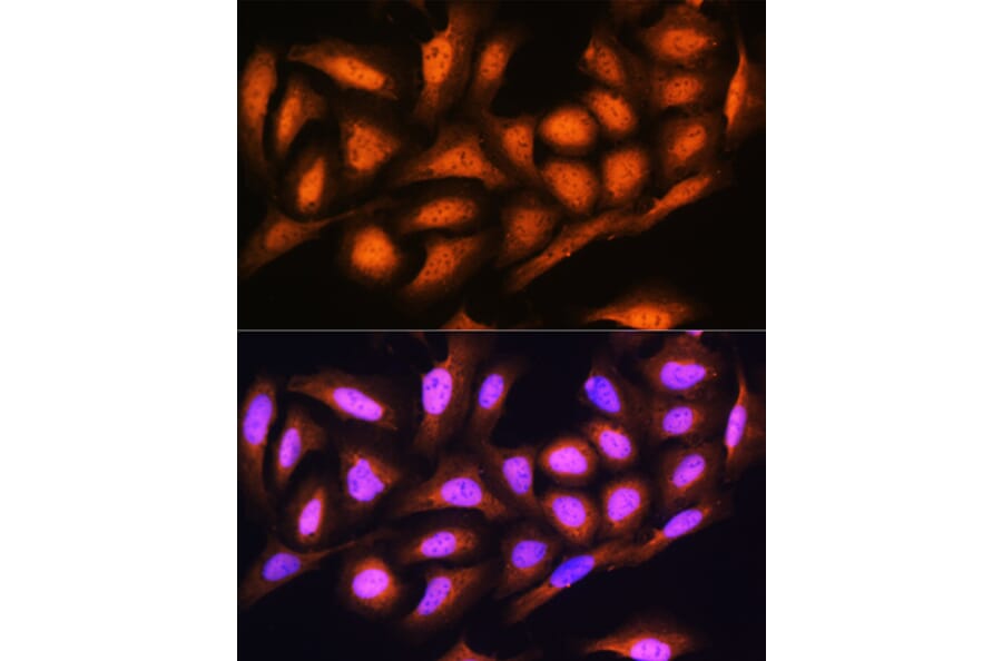 Immunofluorescence - Anti-Proteasome 19S S5A/ASF Antibody (A13015) - Antibodies.com