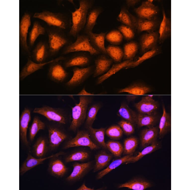 Immunofluorescence - Anti-Proteasome 19S S5A/ASF Antibody (A13015) - Antibodies.com