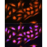 Immunofluorescence - Anti-Proteasome 19S S5A/ASF Antibody (A13015) - Antibodies.com