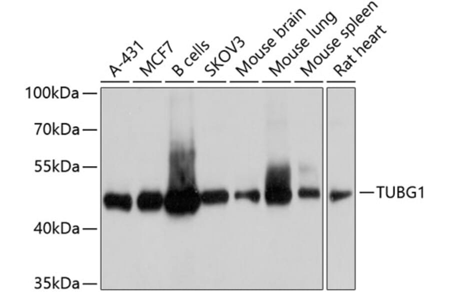Western Blot - Anti-TUBG1 Antibody (A10611) - Antibodies.com