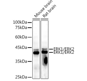 Western Blot - Anti-ERK1 + ERK2 Antibody [AMC0488] (A13017) - Antibodies.com