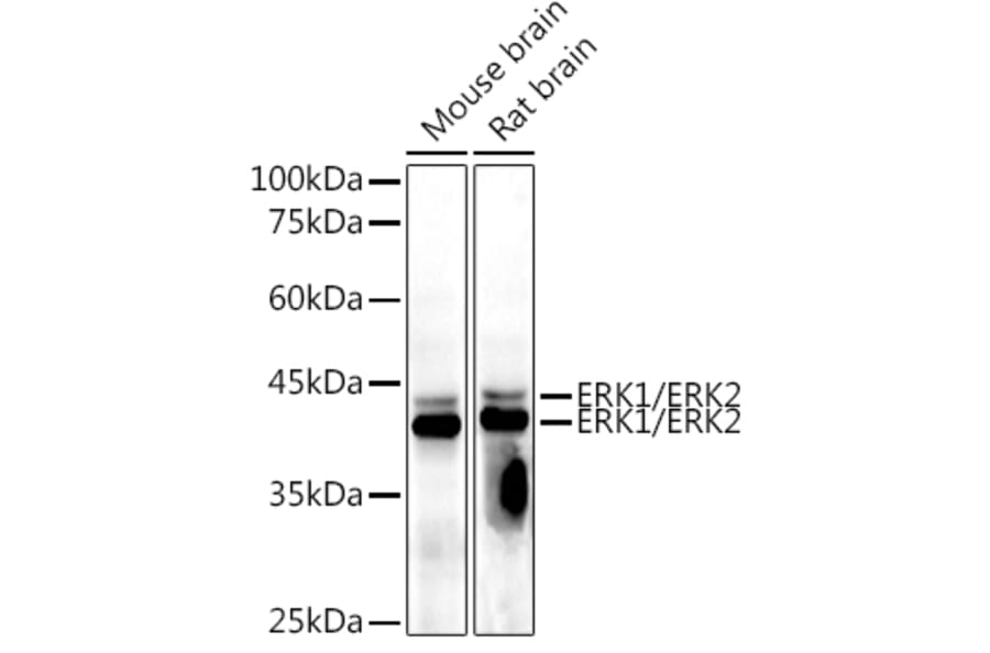 Western Blot - Anti-ERK1 + ERK2 Antibody [AMC0488] (A13017) - Antibodies.com