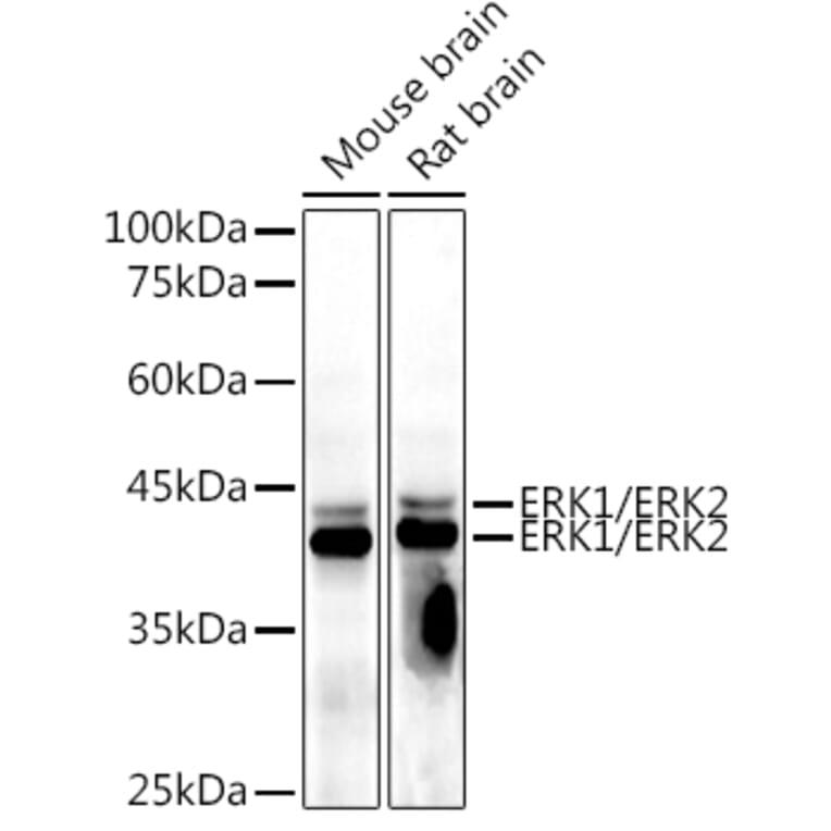 Western Blot - Anti-ERK1 + ERK2 Antibody [AMC0488] (A13017) - Antibodies.com