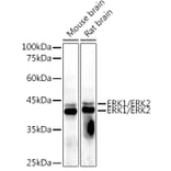 Western Blot - Anti-ERK1 + ERK2 Antibody [AMC0488] (A13017) - Antibodies.com