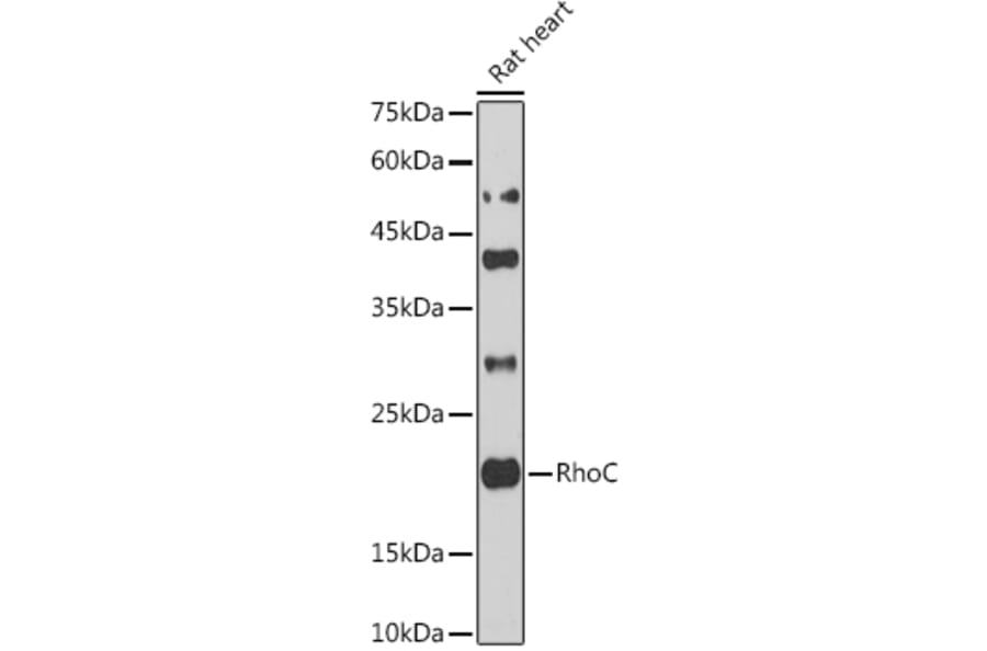 Western Blot - Anti-RhoC Antibody (A13018) - Antibodies.com