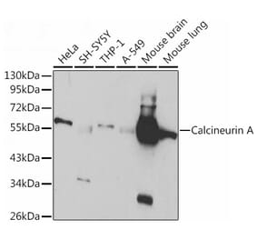 Western Blot - Anti-Calcineurin A Antibody (A13019) - Antibodies.com