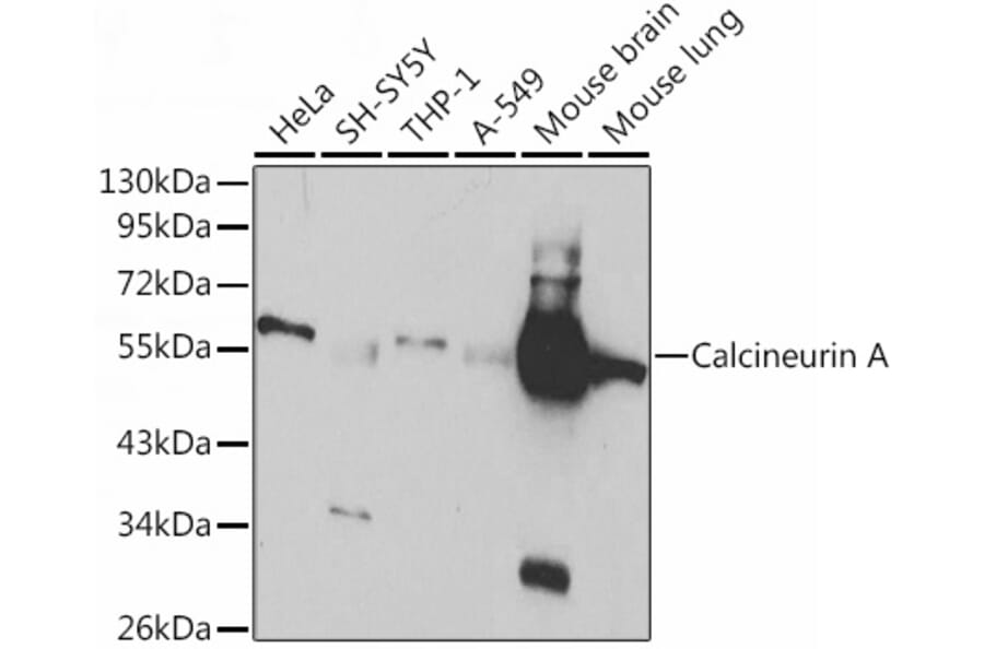 Western Blot - Anti-Calcineurin A Antibody (A13019) - Antibodies.com