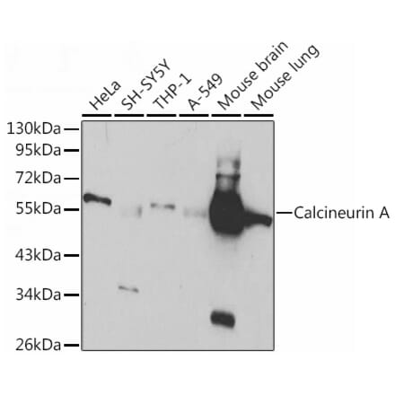 Western Blot - Anti-Calcineurin A Antibody (A13019) - Antibodies.com