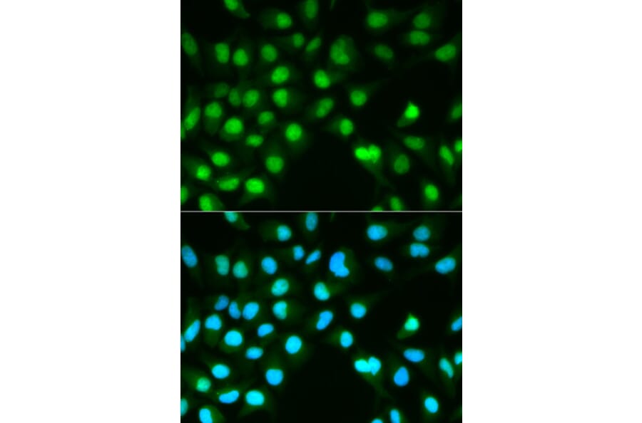 Immunofluorescence - Anti-Calcineurin A Antibody (A13019) - Antibodies.com