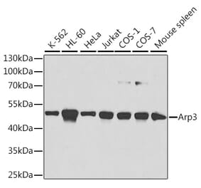Western Blot - Anti-Arp3 Antibody (A13020) - Antibodies.com