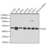 Western Blot - Anti-Arp3 Antibody (A13020) - Antibodies.com