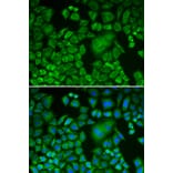 Immunofluorescence - Anti-Arp3 Antibody (A13020) - Antibodies.com