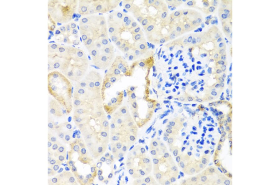Immunohistochemistry - Anti-Cripto1/CRIPTO Antibody (A13021) - Antibodies.com