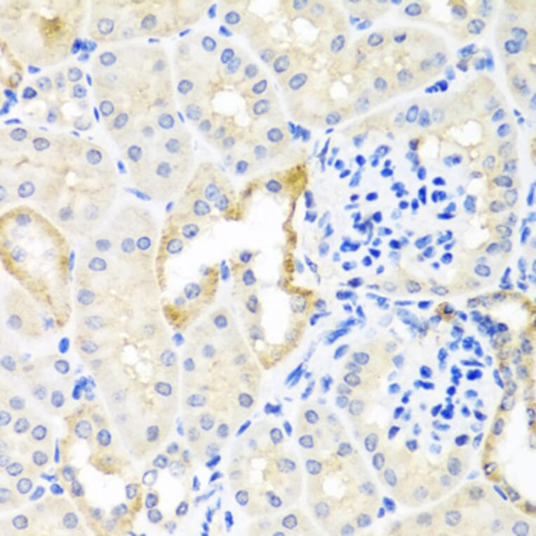 Immunohistochemistry - Anti-Cripto1/CRIPTO Antibody (A13021) - Antibodies.com