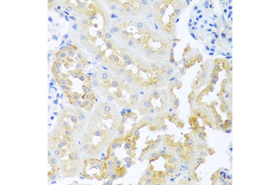 Immunohistochemistry - Anti-Cripto1/CRIPTO Antibody (A13021) - Antibodies.com