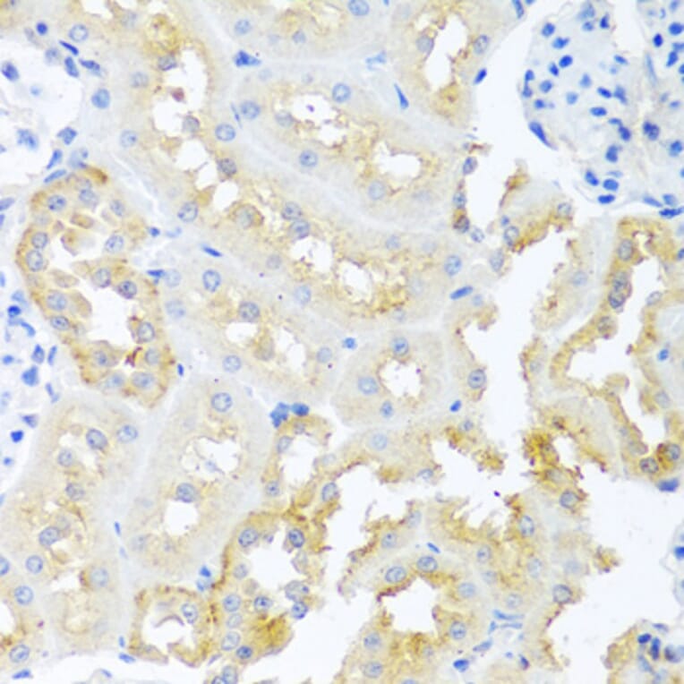Immunohistochemistry - Anti-Cripto1/CRIPTO Antibody (A13021) - Antibodies.com