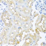 Immunohistochemistry - Anti-Cripto1/CRIPTO Antibody (A13021) - Antibodies.com
