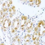 Immunohistochemistry - Anti-Cripto1/CRIPTO Antibody (A13021) - Antibodies.com
