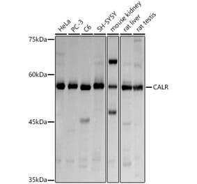 Western Blot - Anti-Calreticulin Antibody (A13022) - Antibodies.com