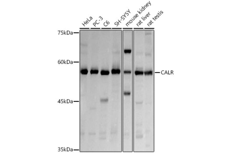Western Blot - Anti-Calreticulin Antibody (A13022) - Antibodies.com