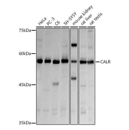 Western Blot - Anti-Calreticulin Antibody (A13022) - Antibodies.com