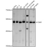 Western Blot - Anti-Calreticulin Antibody (A13022) - Antibodies.com
