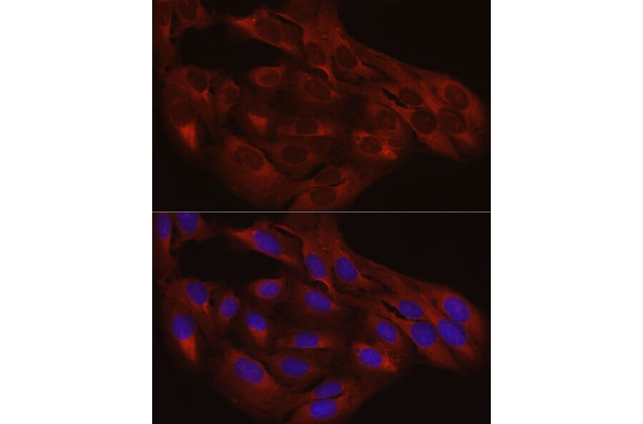 Immunofluorescence - Anti-Calreticulin Antibody (A13022) - Antibodies.com