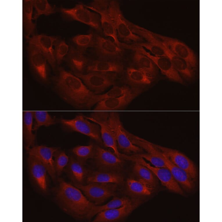 Immunofluorescence - Anti-Calreticulin Antibody (A13022) - Antibodies.com