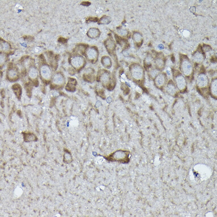 Immunohistochemistry - Anti-Calreticulin Antibody (A13022) - Antibodies.com