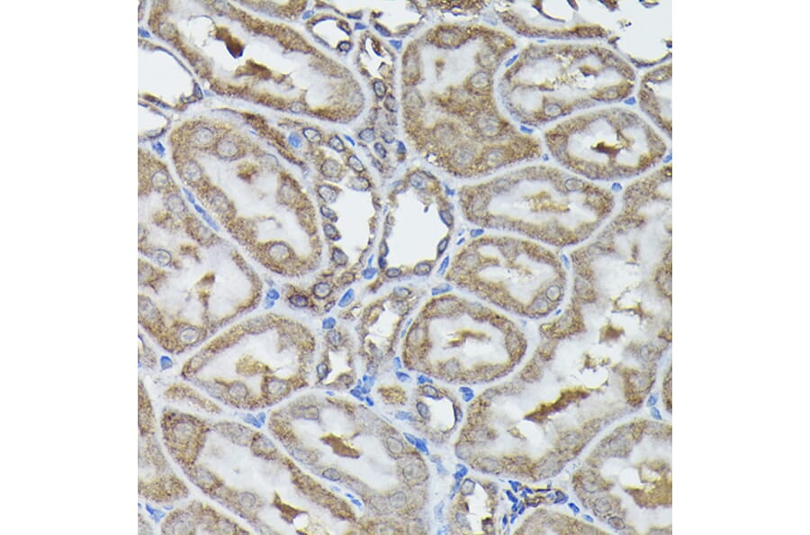 Immunohistochemistry - Anti-Calreticulin Antibody (A13022) - Antibodies.com