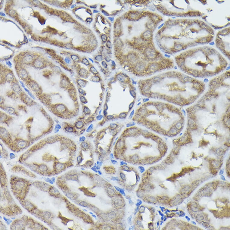 Immunohistochemistry - Anti-Calreticulin Antibody (A13022) - Antibodies.com