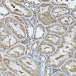 Immunohistochemistry - Anti-Calreticulin Antibody (A13022) - Antibodies.com