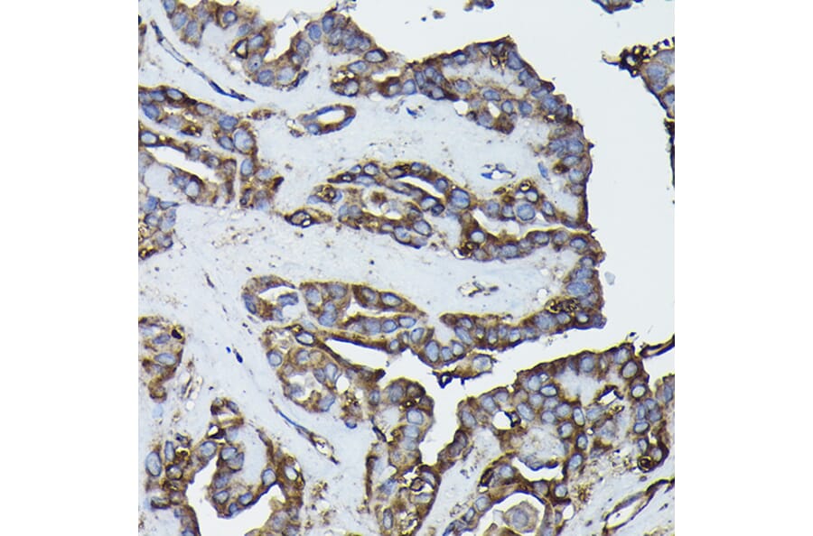 Immunohistochemistry - Anti-Calreticulin Antibody (A13022) - Antibodies.com