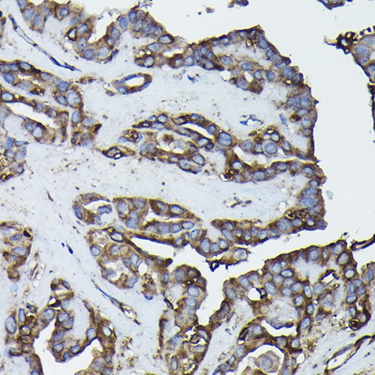 Immunohistochemistry - Anti-Calreticulin Antibody (A13022) - Antibodies.com