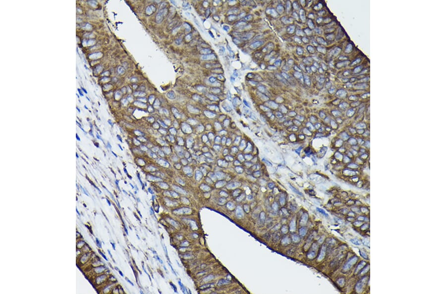 Immunohistochemistry - Anti-Calreticulin Antibody (A13022) - Antibodies.com