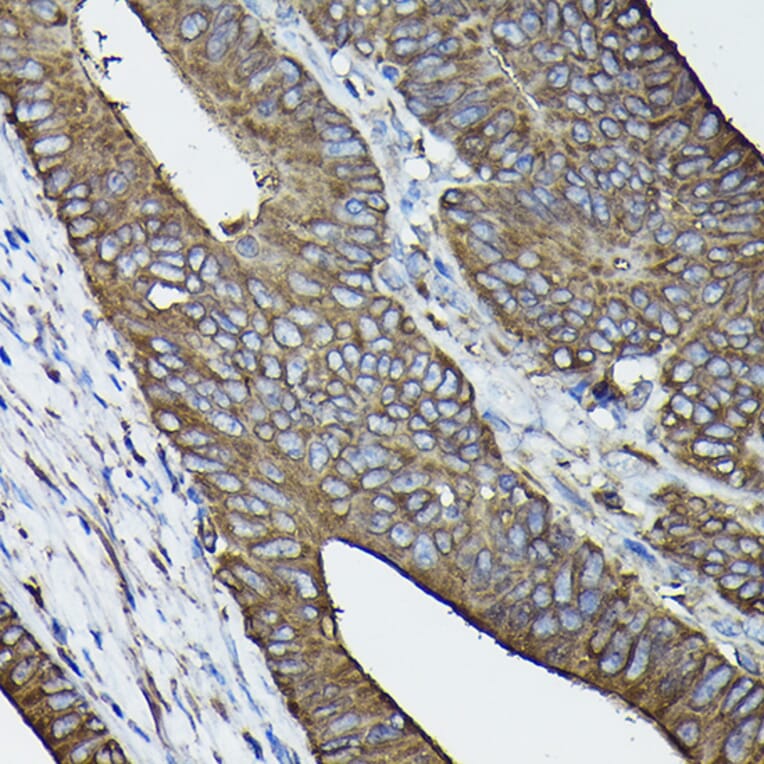 Immunohistochemistry - Anti-Calreticulin Antibody (A13022) - Antibodies.com