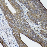 Immunohistochemistry - Anti-Calreticulin Antibody (A13022) - Antibodies.com