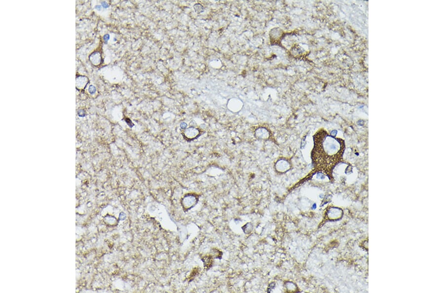 Immunohistochemistry - Anti-Calreticulin Antibody (A13022) - Antibodies.com