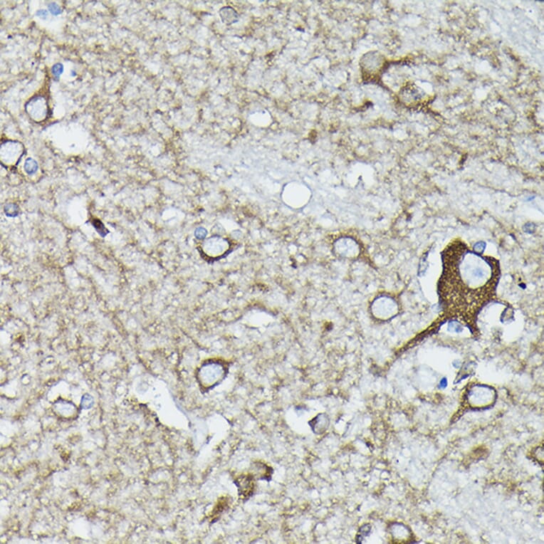 Immunohistochemistry - Anti-Calreticulin Antibody (A13022) - Antibodies.com